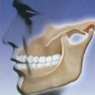 Gnatologia e Malocclusioni