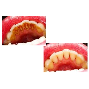 Igiene e Profilassi dentale