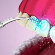 Igiene e Profilassi dentale