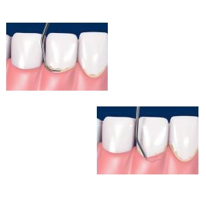 Igiene e Profilassi dentale