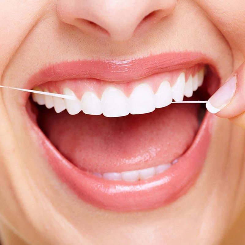 Igiene e Profilassi dentale