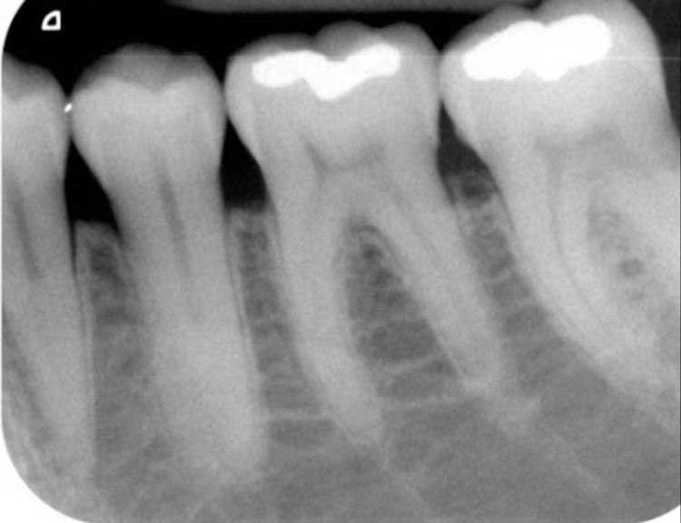 Radiografia digitale