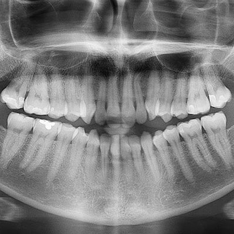 Radiografia digitale