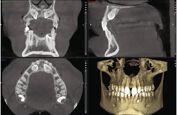 Radiografia digitale