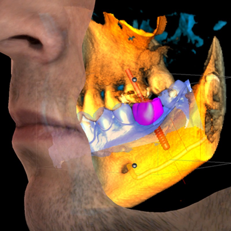 Radiografia digitale