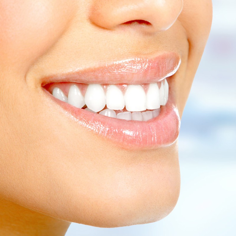 Ricostruzioni dentali estetiche